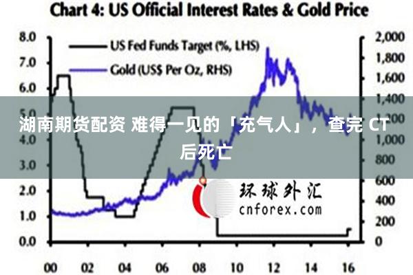 湖南期货配资 难得一见的「充气人」，查完 CT 后死亡